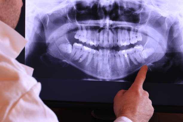 Best Emergency Root Canal Treatment in Dublin, TX